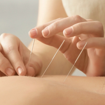 acupuncture surrey